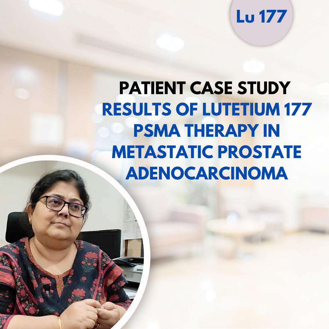 Patient Case Study - Results of Lutetium 177 PSMA Therapy ( Pluvicto ) in Metastatic Prostate Adenocarcinoma